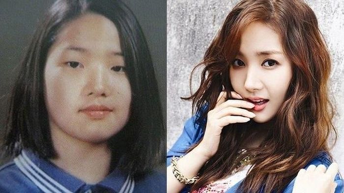 Park Min Young là ca phẩu thuật thẩm mỹ đỉnh cao của Hàn Quốc