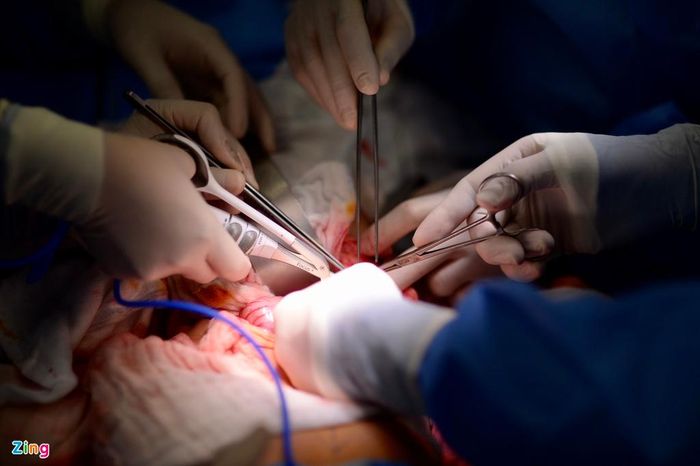  Để có máu cho hai bé sử dụng trong suốt ca mổ, bệnh viện đã đăng ký 16 đơn vị hồng cầu lắng, 12 đơn vị huyết tương tươi đông lạnh và 12 đơn vị tiểu cầu. 