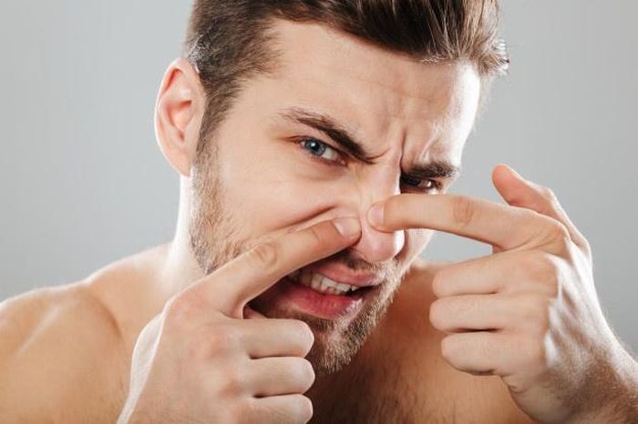Không nên tự ý nặn mụn. Ảnh: Freepik.