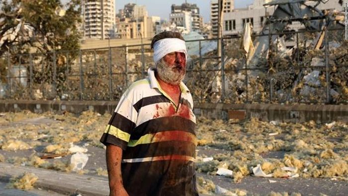  Ít nhất hơn 2.800 người đã thương vong, CNN dẫn nguồn tin từ Bộ Y tế Lebanon. Ảnh: CNN.