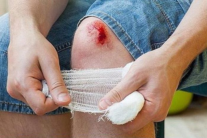 Vết xước nhẹ không được chăm sóc kỹ có thể sẽ bị nhiễm trùng.