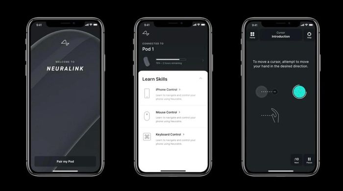  Elon Musk cho rằng con chip Neuralink có thể giúp mọi người học kỹ năng mới một cách đơn giản. Ảnh: Neuralink. 