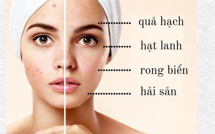 Da bị mụn: Khi các tuyến bã nhờn hoạt động mạnh khiến lỗ chân lông bị bít tắc, vi khuẩn sinh sản nhanh hơn gây viêm da và mụn. Một chế độ ăn uống đặc biệt có thể giúp bạn giải quyết vấn đề mụn trứng cá. Điều quan trọng nhất là bạn cần ăn nhiều thực phẩm có axit béo không bão hòa để làm dịu tình trạng viêm. Bạn cũng có thể ăn thêm trái cây, rau, quả hạch, quả óc chó, hạt lanh, rong biển và hải sản.
