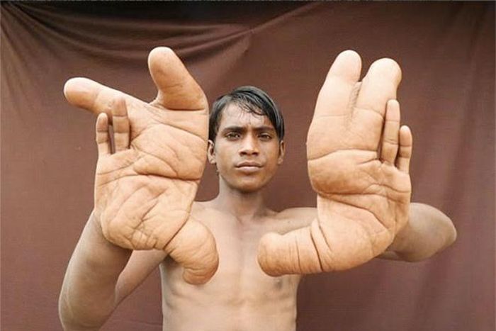 Chúng khổng lồ khiến nhiều người sợ.