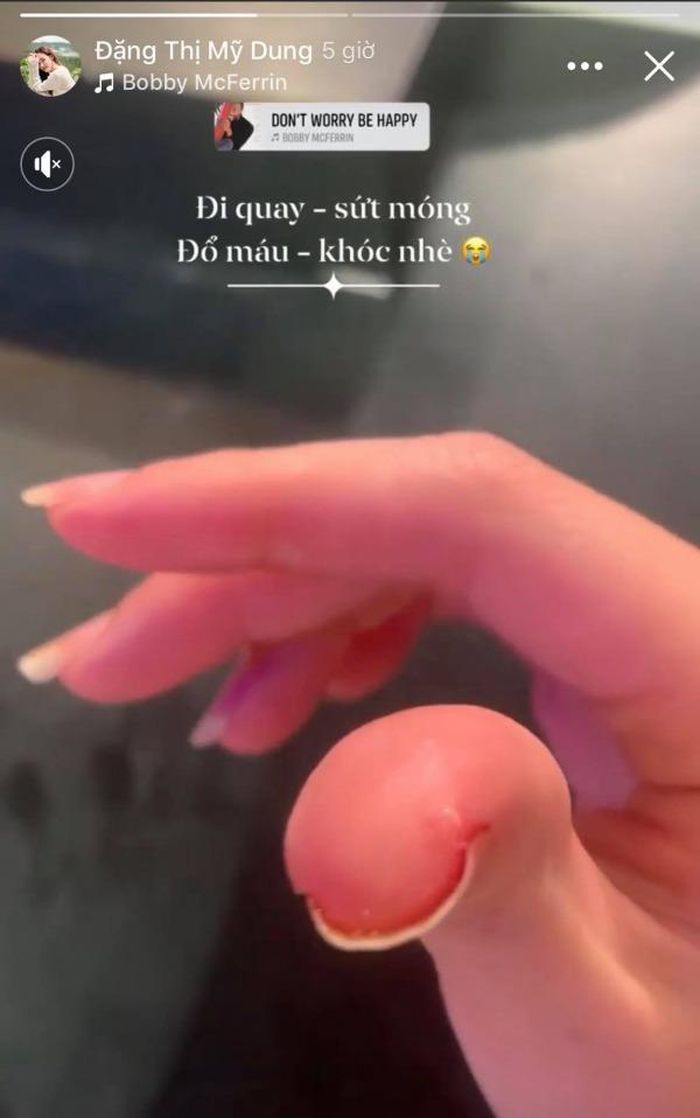 Để móng tay dài cộng với móng không chắc khỏe rất dễ gặp phải tình trạng bong tróc và gãy như Midu, đây là cảm giác vô cùng đau đớn với phái đẹp.