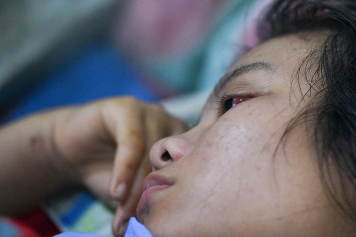  Đôi mắt Mỹ Kim vẫn tụ máu vì chấn thương. 