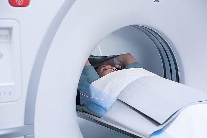Chụp cộng hưởng từ tìm nguyên nhân gây tai biến mạch máu não