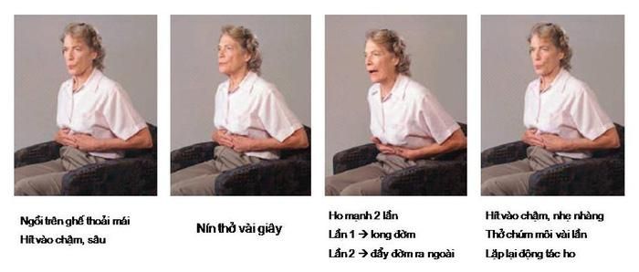Các bước cách ho cho bệnh nhân phổi tắc nghẽn mãn tính - Ảnh: Internet