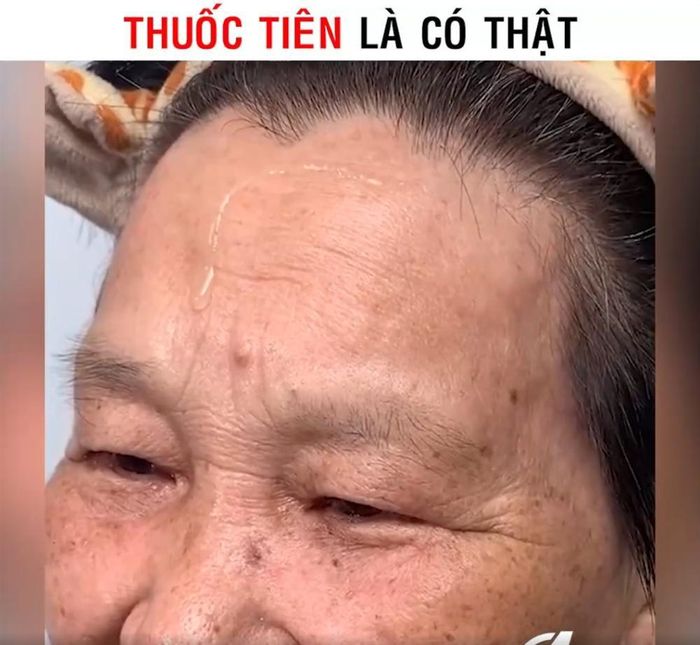 Làn da của người phụ nữ trung niên với nhiều khuyết điểm trước khi thoa serum