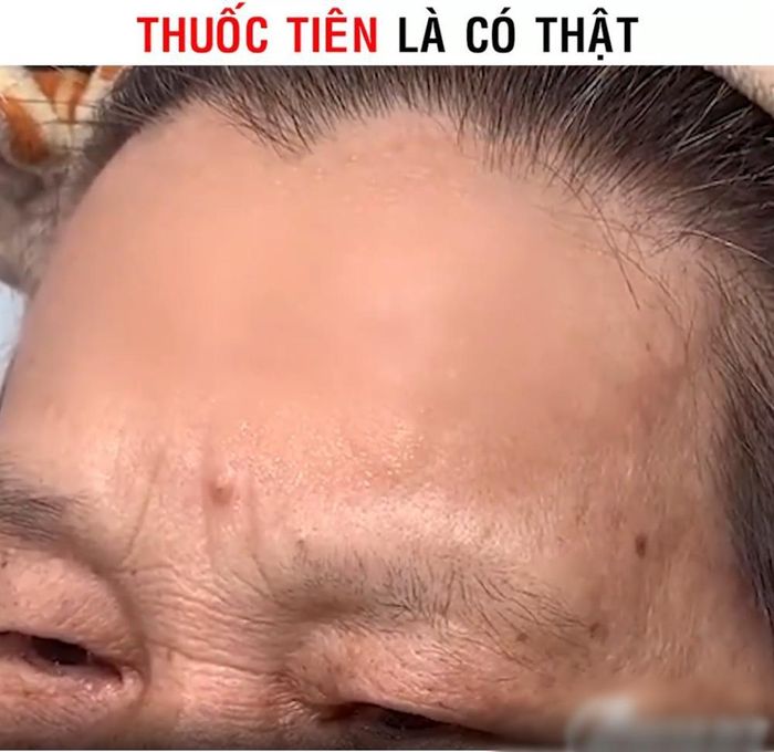 Sau khi thoa chỉ trong chưa đầy 1 phút, phần trán mịn màng như da em bé. 