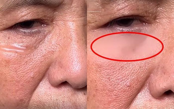 Công dụng quá thần kỳ khiến lọ serum này được gọi là "thuốc tiên", "thần dược". 