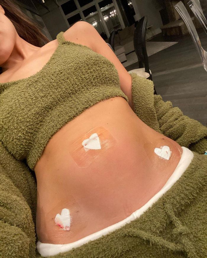Olivia Culpo chia sẻ hình ảnh đau đớn trên giường bệnh.