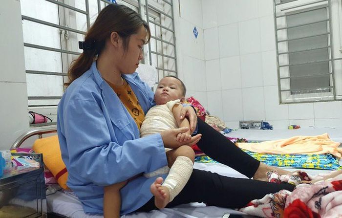 Bé A dần hồi phục sau khi được mẹ đưa đưa đến viện điều trị. Ảnh: Zing.