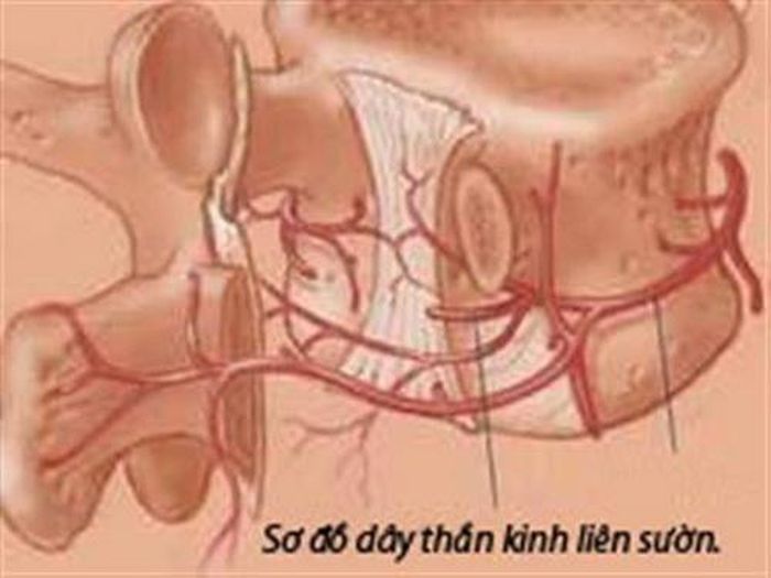 Cần lưu ý tới các tác dụng phụ khi dùng thuốc trị đau dây thần kinh liên sườn.