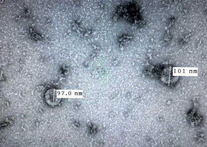 Chủng virus corona mới (nCoV) được Viện vệ sinh dịch tễ Trung ương nuôi cấy và phân lập thành công. (Ảnh: TTXVN phát)