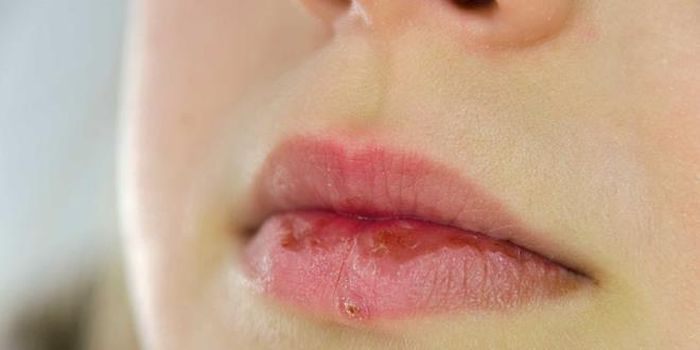 Lạm dụng quạt sưởi chính là thói quen xấu khiến môi khô nẻ.