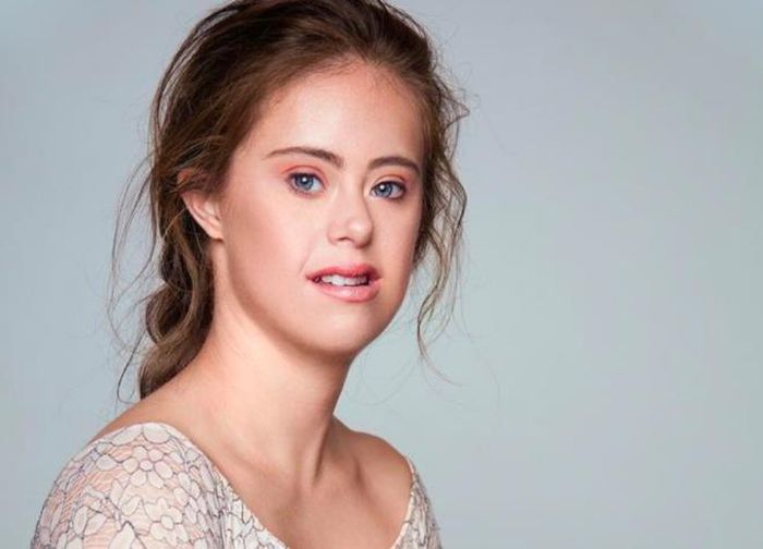 Trong ảnh Chelsea Werner, một cô gái mắc hội chứng Down đã nỗ lực trở thành một người mẫu nổi tiếng thế giới và là nhà vô địch Olympic 4 lần.