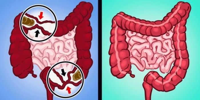 Ăn sữa chua: Mặc dù một số người khuyên không nên dùng các sản phẩm làm từ sữa khi bị táo bón, nhưng sữa chua là một ngoại lệ. Bởi trong sữa chua chứa vô số các chất lợi khuẩn giúp chấm dứt tình trạng táo bón rất nhanh chóng.