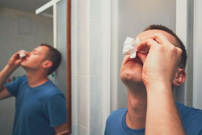 Chảy máu cam: Ngoài nguyên nhân bệnh tật, thì việc thiếu vitamin C cũng là nguyên nhân khiến bạn dễ bị chảy máu cam. Tình trạng này xảy ra khi các mạch máu nhỏ ở mũi thiếu vitamin C và trở nên yếu ớt, dễ vỡ.