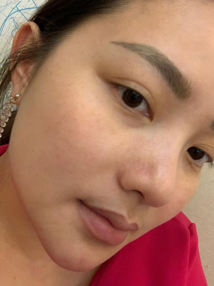 Làm da của mỹ nhân cũng xuống cấp trầm trọng với lỗ chân lông to, sần sùi và không được tươi sáng.