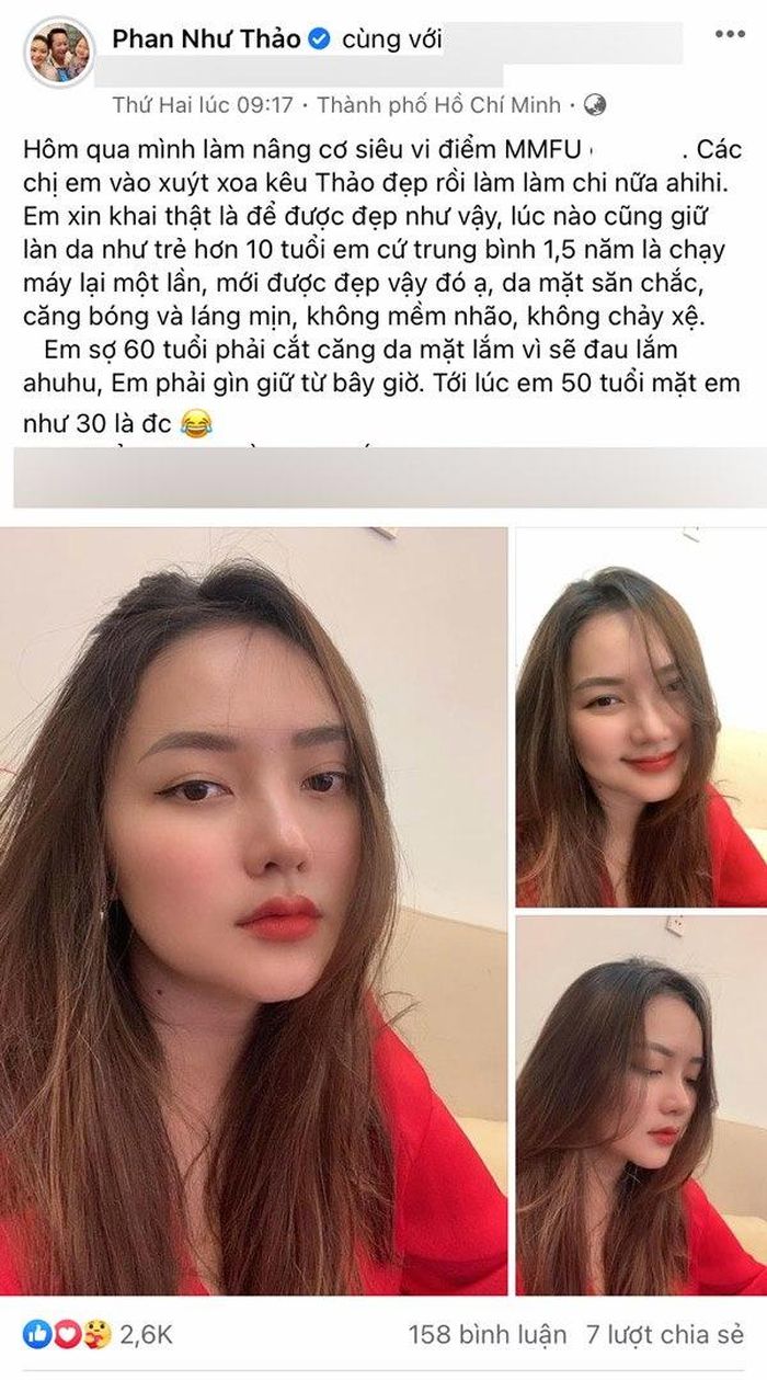 Theo đó, Phan Như Thảo đã can thiệp phương pháp thẩm mỹ nâng cơ căng da mặt để trở nên trẻ trung tươi tắn hơn, cũng như cho làn da căng mịn, gương mặt thanh thoát. 