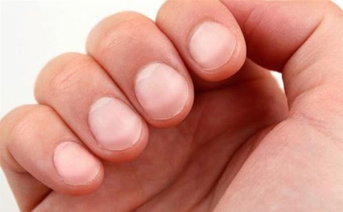 Móng dùi trống có thể do bệnh lý ở phổi, tim mạch, gan.