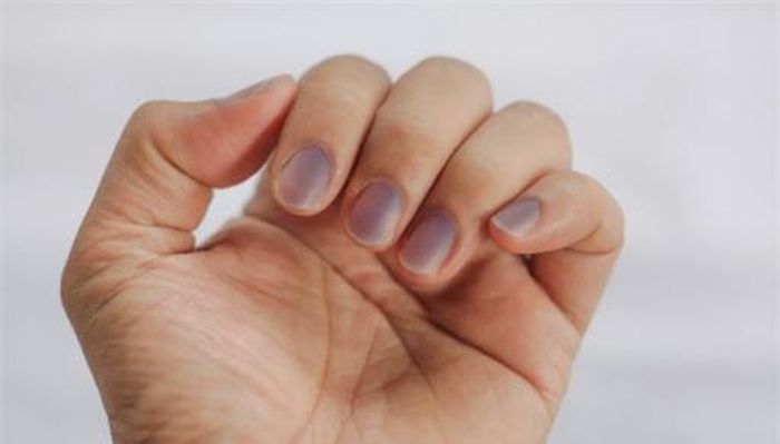Móng tay hơi xanh hoặc tím: Có thể cơ thể bạn đang thiếu oxy.