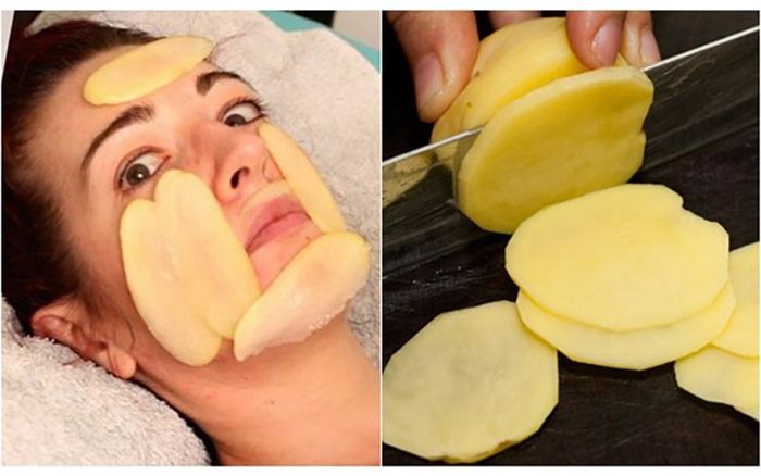 Khoai tây điều trị sắc tố da: Nhờ các chất tẩy trắng trong khoai tây làm cho nó trở thành phương thuốc vô cùng hữu hiệu để điều trị sắc tố da. Cách sử dụng: Lấy chiết xuất nước khoai tây và rửa mặt với nó sau đó rửa mặt lại bằng nước ấm. Lặp lại phương pháp này hai lần một tuần để có được kết quả hiệu quả tốt nhất.