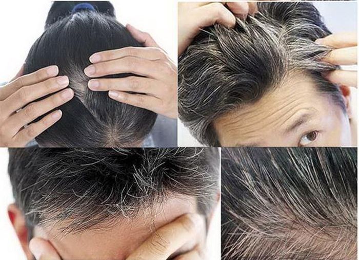Đậu tương chữa tóc bạc sớm.