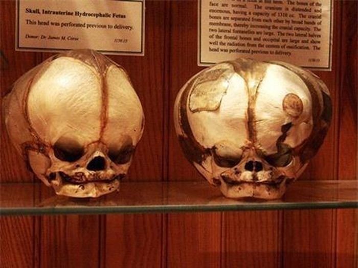  Vé vào cửa để được vào thánh đường “y học kinh hoàng”, trải nghiệm sự … khiếp sợ trong chốc lát là 14 đôla.