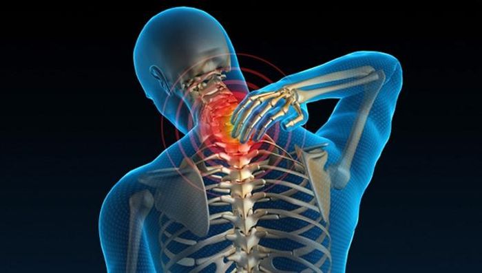 Bệnh lý đốt sống cổ là một trong những nguyên nhân gây tê tay.