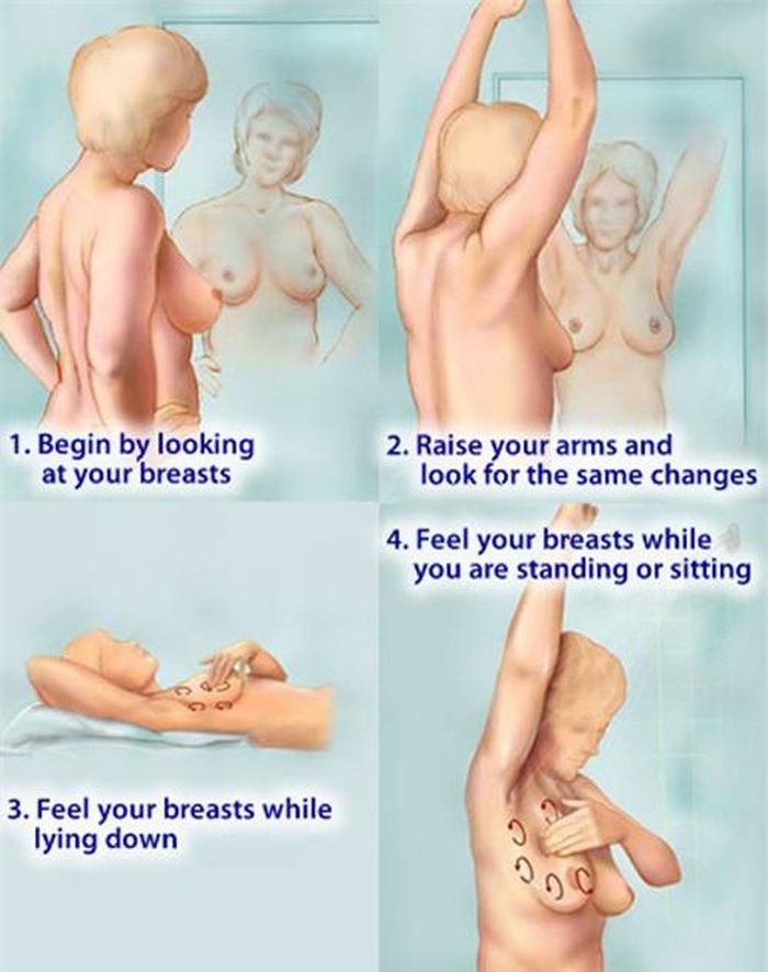 Tự khám vú tại nhà để phát hiện sớm nhất ung thư vú