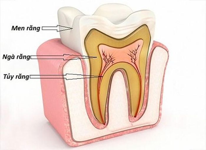 Ngà răng bị lộ khiến răng bị kích thích với các yếu tố bên ngoài