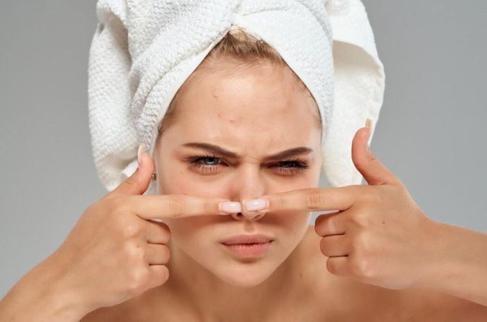 Cào nặn mụn là thói quen không tốt vì nó khiến cho mụn lún sâu hơn vào da, vi khuẩn cũng thâm nhập sâu hơn, làm nặng hơn tình trạng nhiễm trùng và có thể để lại sẹo xấu. Ảnh: Women's Health.