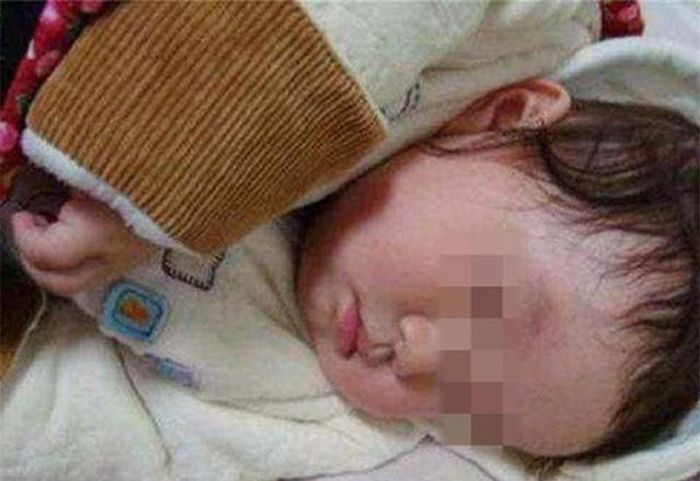 Bên cạnh những lợi ích tuyệt vời, quấn khăn cho bé cũng có thể dẫn đến những nguy cơ sức khỏe.