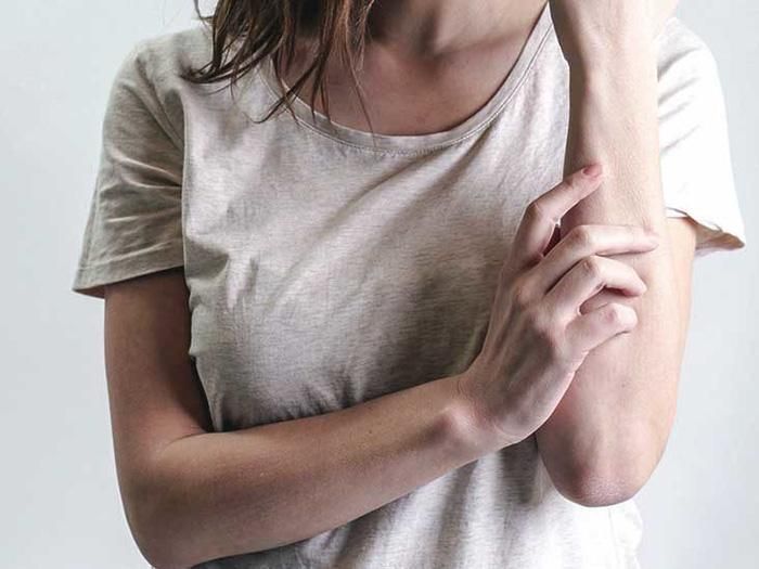 Thực tế, mất nhiều thời gian để tìm ra cách tốt nhất đem lại hiệu quả kiểm soát phát ban - Ảnh Internet