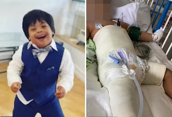 Jose trước khi bị ngã (trái) và khi nằm viện điều trị gãy xương đùi sau cú ngã (phải). Ảnh gia đình cung cấp cho NBC.