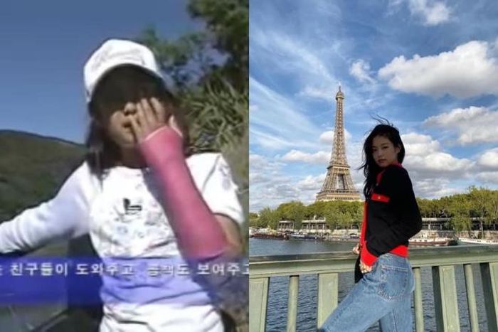 Jennie thuở nhỏ vì tiếc lon nước ngọt mà bị gãy tay. Ảnh: Twitter