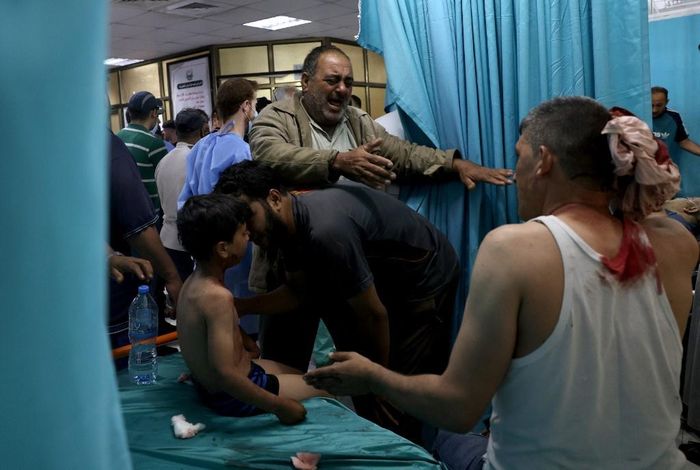  Những người Palestine bị thương được sơ cứu tại bệnh viện sau cuộc không kích của Israel. Ảnh: AFP. 