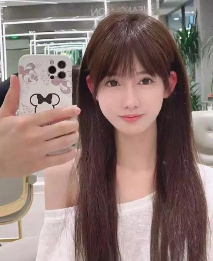 Blogger Trung Quốc bị chỉ trích khi chia sẻ về việc phẫu thuật "tai yêu tinh".