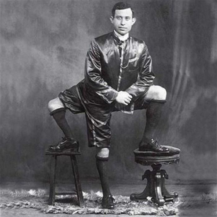 Frank Letini – người đàn ông 3 chân.