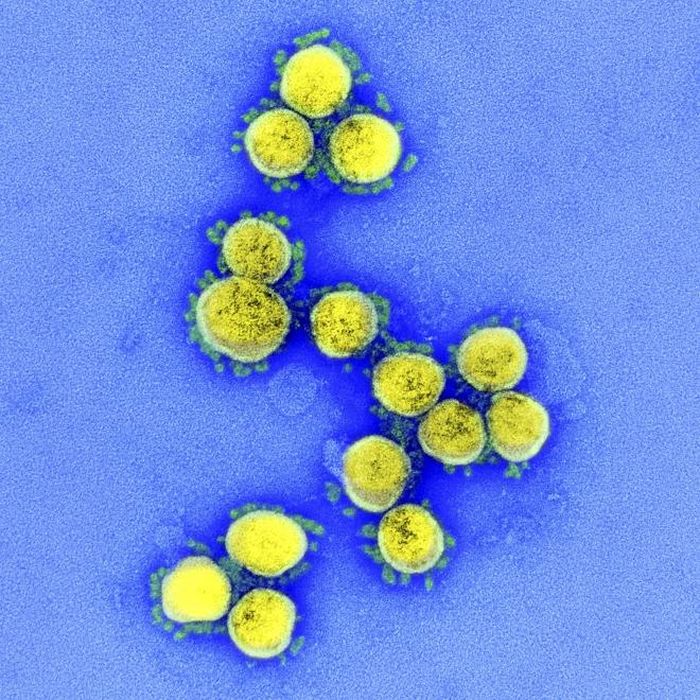 Virus SARS-CoV-2. Nguồn: TTXVN