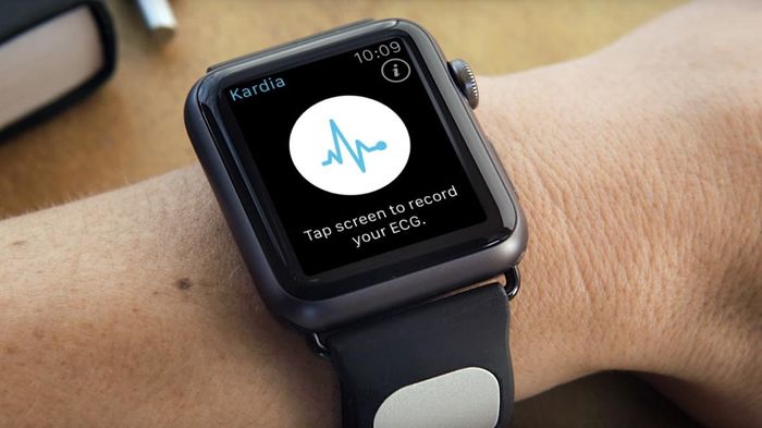 Sản phẩm của AliveCor bị Apple "bức tử"? Ảnh: Wareable.