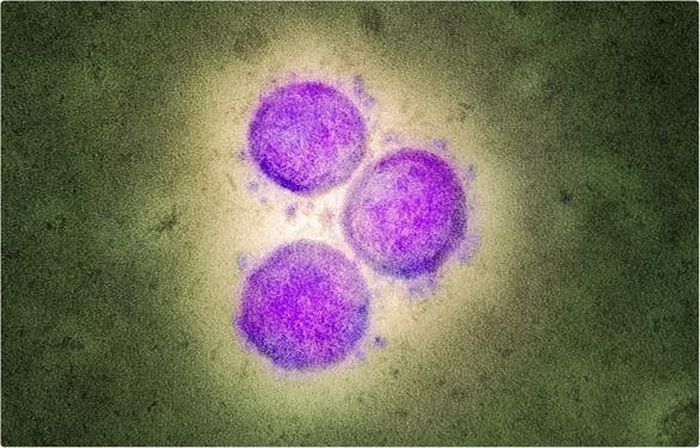  Các hạt biến chủng virus B.1.1.7 từ mẫu bệnh nhân trong phòng thí nghiệm. Ảnh: NIAID. 