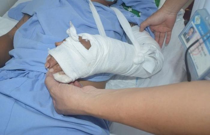 Bàn tay của bệnh nhân đã nồng ấm, cử động được.