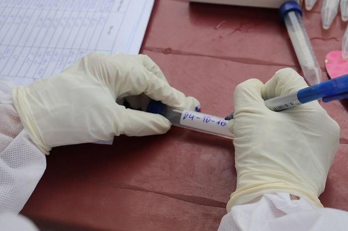 Nhân viên CDC Đồng Nai khai thác thông tin người dân và ghi mã số mẫu bệnh phẩm lên lọ đựng lấy mẫu. Tránh không để sai sót thông tin người lấy mẫu