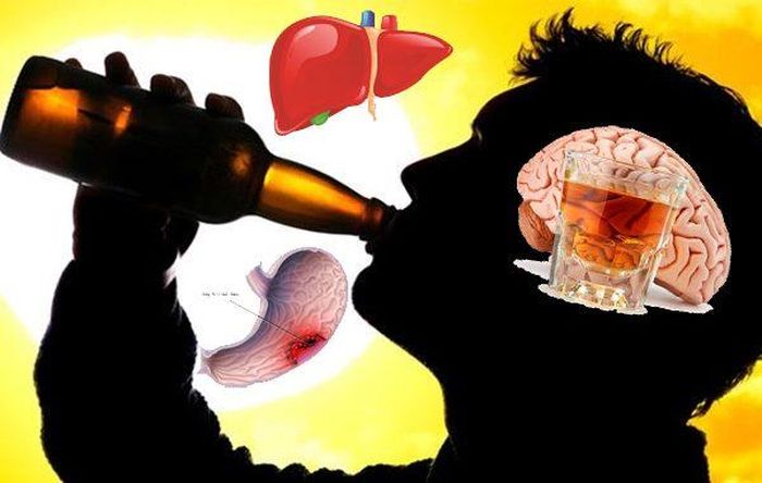 Rượu bia. Kết luận của Tổ chức Nghiên cứu Ung thư quốc tế (IARC) cho thấy rượu bia là chất gây ung thư khoang miệng, họng, thanh quản, thực quản, đại trực tràng, gan và ung thư vú ở phụ nữ. Tiêu thụ rượu bia ở mức độ nào cũng có nguy cơ ung thư.