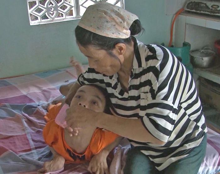 Hàng ngày, vợ chồng ông Lê Tấn Dũng thay nhau chăm sóc các con bị nhiễm chất độc da cam. Ảnh: Thiên Di