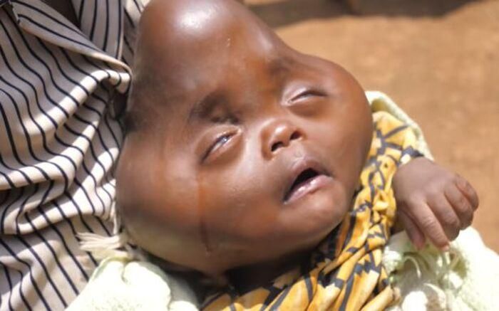Người phụ nữ Rwanda mong có thể quyên góp được đủ tiền để đưa con ra nước ngoài khám chữa bệnh.