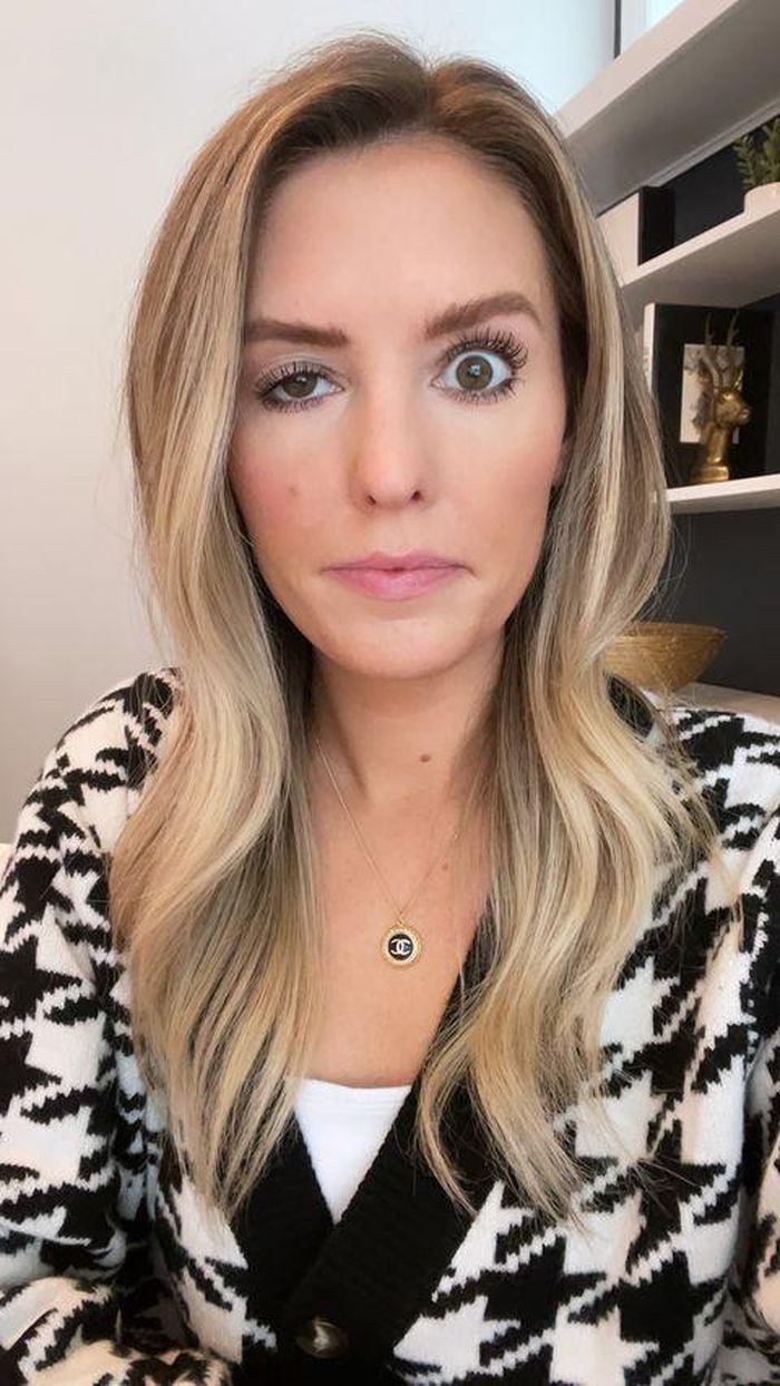 Whitney Buha bị sụp mí mắt sau khi tiêm botox. Ảnh: Cosmopolitan. 